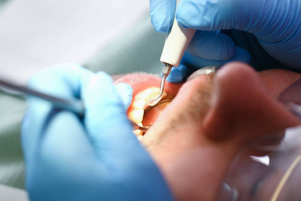 Best Tooth Infection Emergency Dentist  in Dunlap, OH