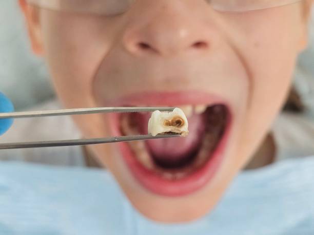 Emergency Gum Pain Relief in OH